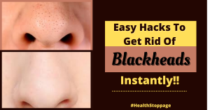 Health Stoppage , blackhead removal,remedy for blackheads,black heads on nose,black heads removal at home,blackhead removal at home,black head face,home remedies for blackheads